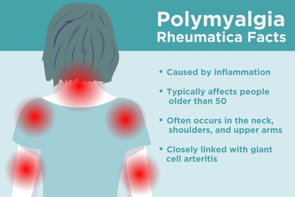 Polymyalgia Rheumatica | Capital Rheumatology