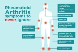 a könyökízület tünetei rheumatoid arthritis