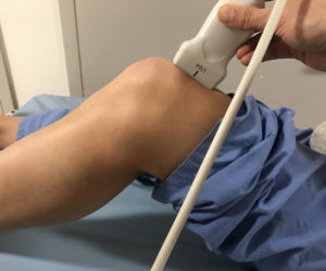 Ultrasound of the Left Knee