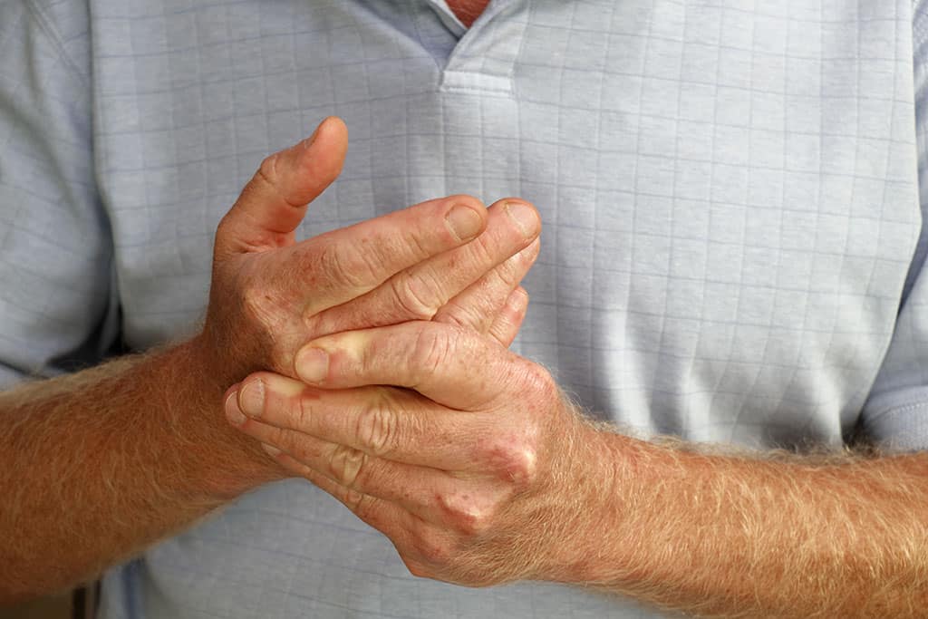 A Man Massages His Wrists With Joint Pain And Needs Scleroderma Treatment